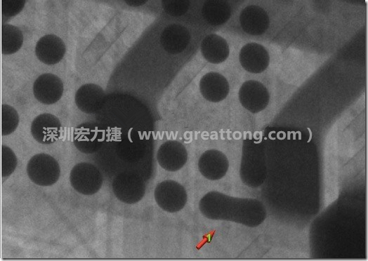BGA因為焊墊變小，造成錫膏過多而最終形成焊接短路的結(jié)果。